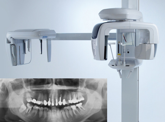 訪問歯科使用機器